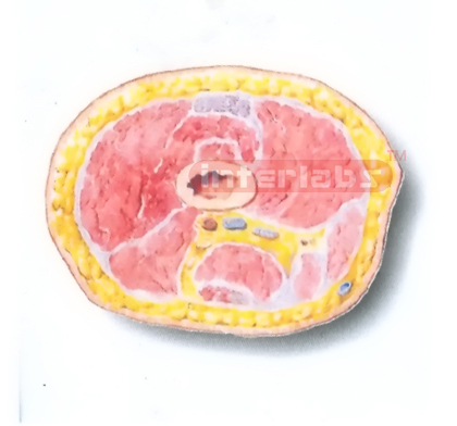 HUMAN TRANSVERSE SECTION MODEL THROUGH THE PROXIMAL 1/3 OF THE RIGHT THIGH (C)